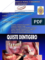 Quiste Dentigero