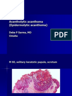 Acantholytic Acanthoma. M 60, Scrotum