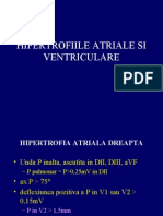 ECG Hipertrofii