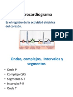 Ekg