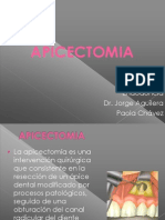 Apicectomia