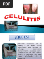 Celulitis