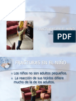 Fracturas en El Nino HGF