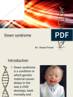 Down Syndrome: By: Deepal Prasad