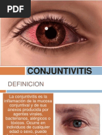 Tema 20 - Conjuntivitis