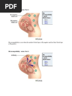 RH Incompatibility - Rupesh