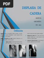 Displasia de Cadera