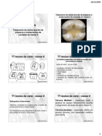 Tratamento de Cárie Através de Preparos e Restaurações de Cavidade Classe II