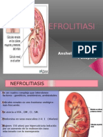 NEFROLITIASIS