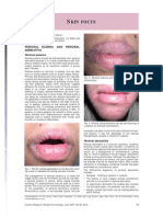 Jurnal Dermatitis Perioral 8