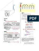 A Simplified ECG Guide