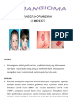 Hemangioma