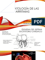 Fisiopatología de Las Arritmias