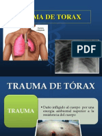 Trauma de Torax