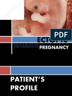 ECTOPIC PREGNANCY Edited by Ainiesam27