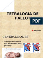 Tetralogia de Fallot