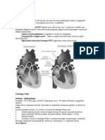 Tetralogia Fallot