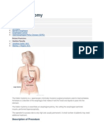 Heller Myotomy: General Surgery