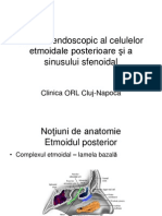 Etmoidectomia Posterioara