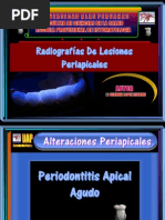 Radiografías de Lesiones Periapicales