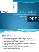 Encefalitis