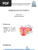 Embarazo Ectopico