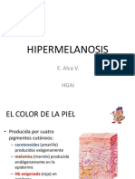 Discromias y Fotodermatosis