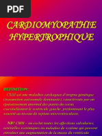 Cardiomyopathie Hypertrophique