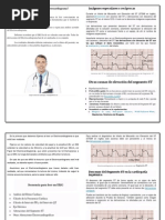 Cómo Leer e Informar Un Electrocardiograma