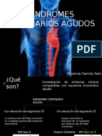 Síndromes Isquémicos Coronarios Agudos