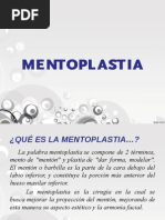 MENTOPLASTIA