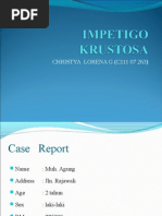 Impetigo Krustosa