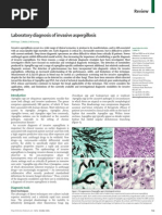 Laboratory Diagnosis of Invasive Aspergillosis