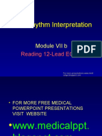 ECG Rhythm Interpretation: Reading 12-Lead ECG's