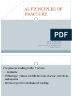 General Principles of Fracture