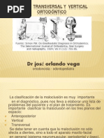 Alteraciones Verticales y Transversales PRESENTACION