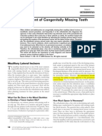 Management of Missing Teeth Kokich