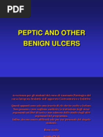 Peptic and Other Benign Ulcers