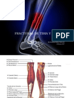 Fracturas de Tibia y Peroné