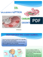 Caso Clinico-Ulcera Peptica .