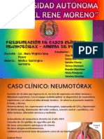 Casos Clinico Neumotórax