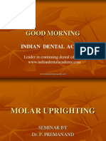 Molar Uprighting / Orthodontic Courses by Indian Dental Academy