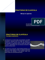 Fracturas de Clavicula