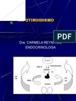 Ts11 Hipotiroidismo