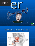 Cáncer de Próstata