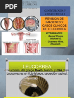 Casos Clínicos de Leucorrea