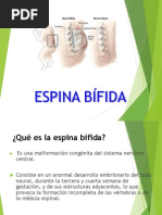 Espina Bifida Presentacion2