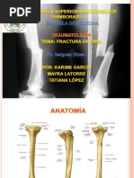 Traumatologia FX Tibia