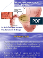 Estenosis Piloro Duodenal Por Ulcera