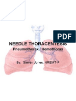 Pneumothorax-Hemopneumothorax Needle Decompression